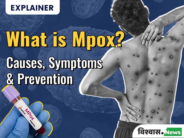 Explainer: Understanding MPox— Symptoms,  Prevention, And Everything You Need To Know